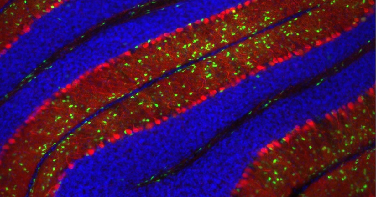 Neuronas De Purkinje Sus Funciones Y Caracter Sticas