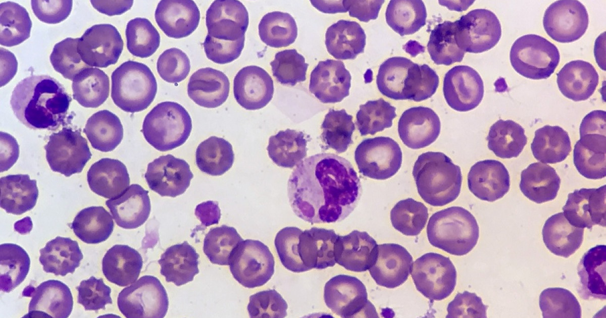 Eritrocitos glóbulos rojos características y funcionamiento