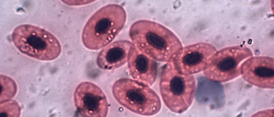 Los 3 tipos de hormonas asociadas al estrés