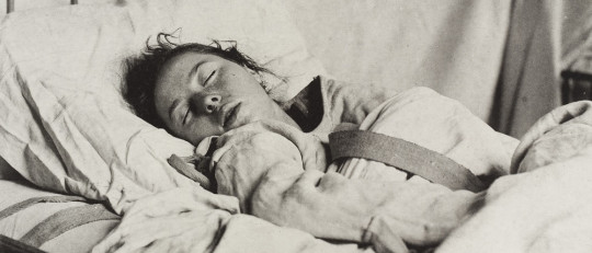 Paciente con histeria.