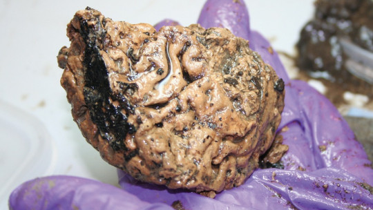 Cerebro de Heslington