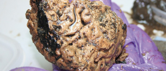 Cerebro de Heslington