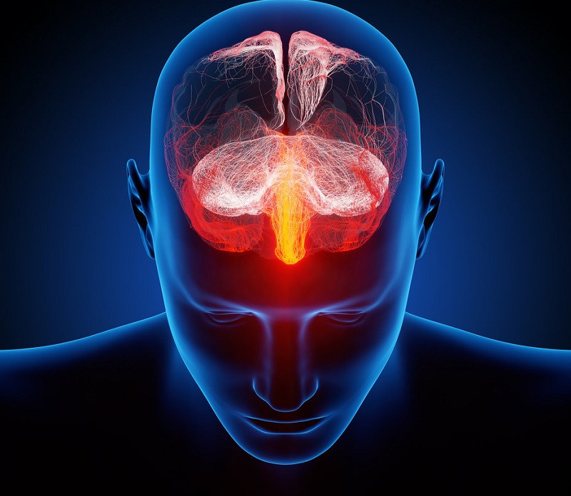 Características de la terapia de neuromodulación inteligente acelerada