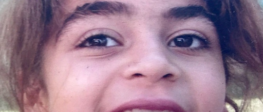 Síndrome de Sanfilippo