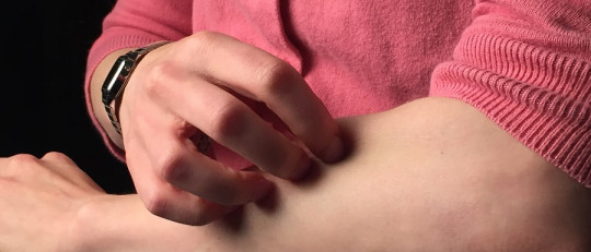 Efectos del estrés en la piel