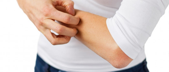 Hombre rascándose el brazo.