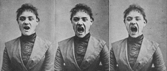 Mujer con síntomas de histeria.