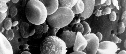 Hormona luteinizante