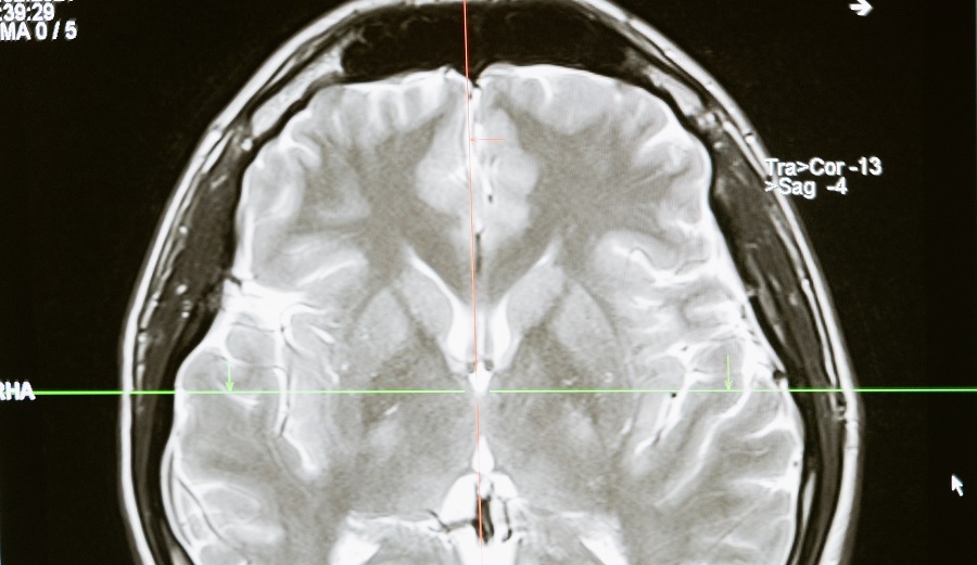 Los mejores Cursos de Neuropsicología