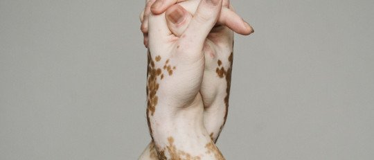 ¿Tiene desventajas el movimiento Body Positivity?