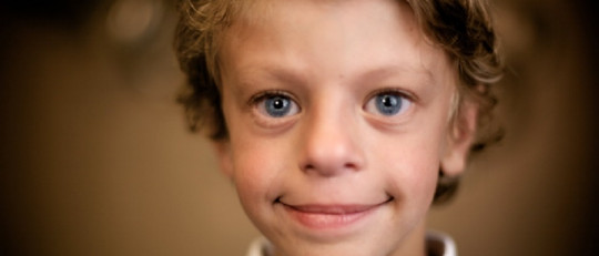 Niño con síndrome de Williams.