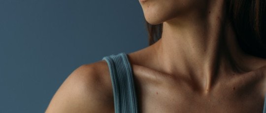 La relación entre los TCA y los Trastornos de Personalidad