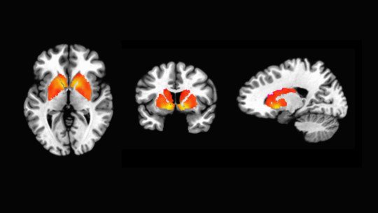 Explorando los Procesos Cognitivos: la Evaluación Neuropsicológica