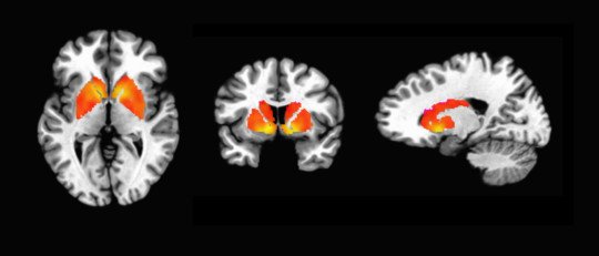 Explorando los Procesos Cognitivos: la Evaluación Neuropsicológica