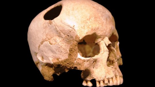 Trepanaciones: ¿por qué nuestros ancestros se perforaban el cráneo?