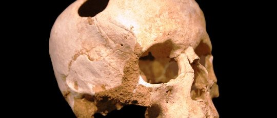 Trepanaciones: ¿por qué nuestros ancestros se perforaban el cráneo?