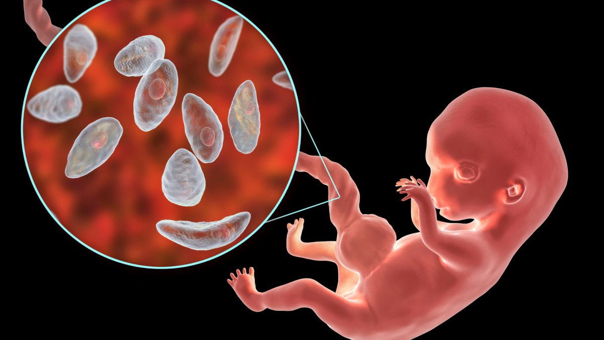 toxoplasmosis-impacto-mente