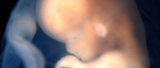 Los efectos de la exposición prenatal al Cannabis