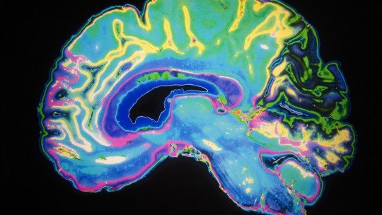 ¿Cuáles son las áreas del cerebro involucradas en la creatividad?