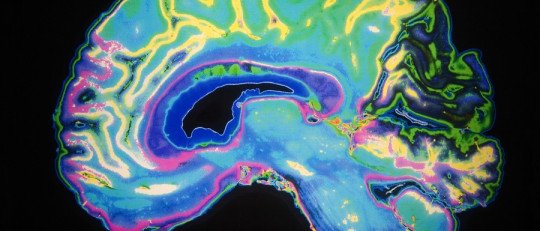 ¿Cuáles son las áreas del cerebro involucradas en la creatividad?