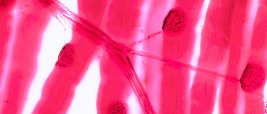 Unión neuromuscular.