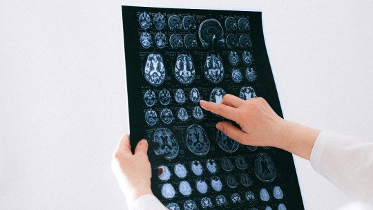 ¿A quiénes va dirigida la Neuropsicología?