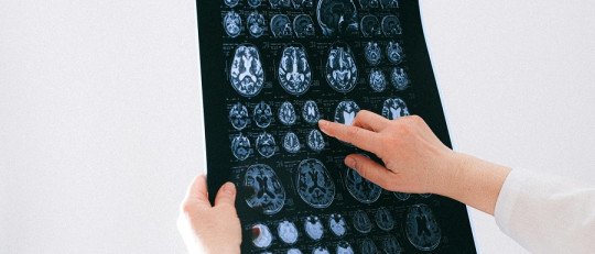 ¿A quiénes va dirigida la Neuropsicología?