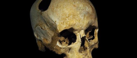 El estudio del Cerebro en la Antigüedad