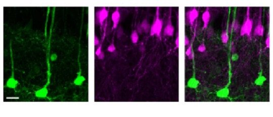 Descubren un tipo de Célula que nos permite recordar nuevas cosas