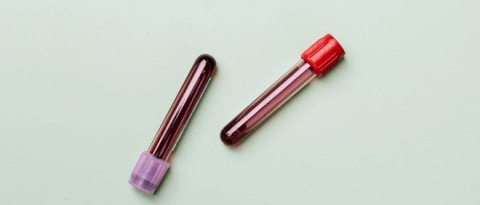 La sangre de las personas con depresión tiene una 'firma metabólica' característica