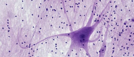 Un tipo de neuronas que regulan la pérdida de apetito pueden ayudar a tratar la obesidad