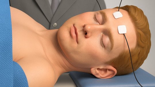 La terapia electrocompulsiva reduce casi un 35% el riesgo de suicidio en la depresión severa