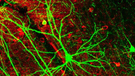 La Red Neuronal por Defecto: uno de los hallazgos más relevantes de la neurociencia moderna