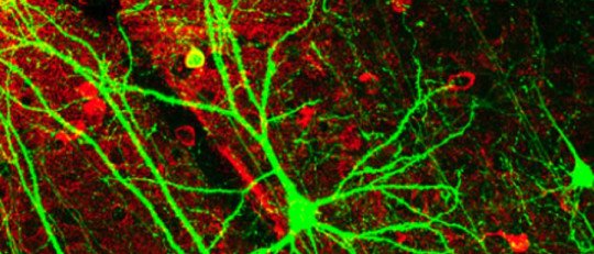 La Red Neuronal por Defecto: uno de los hallazgos más relevantes de la neurociencia moderna
