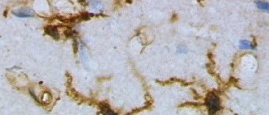 Descubren dos tipos de células nerviosas vinculadas a la depresión