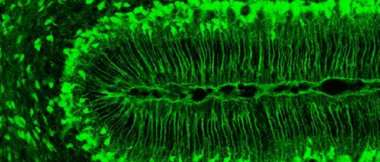 Células gliales radiales