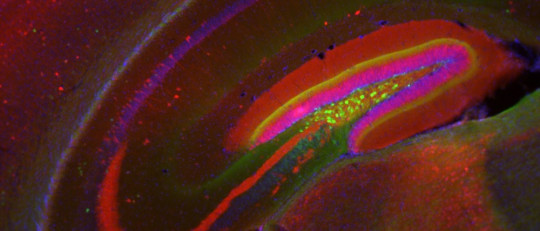 Formación hipocampal