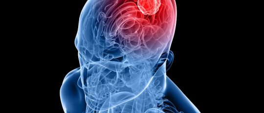 La comorbilidad entre la drogadicción y otros trastornos mentales