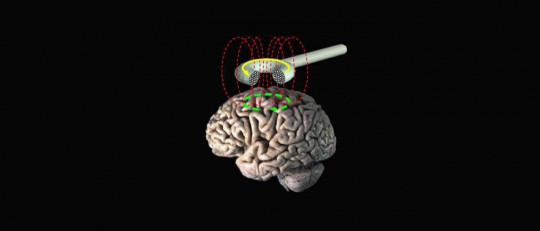 Estimulación magnética transcraneal