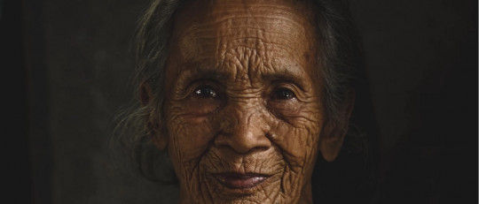 Psicosis en la enfermedad del Parkinson