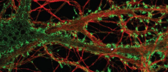 Neuronas dopaminérgicas