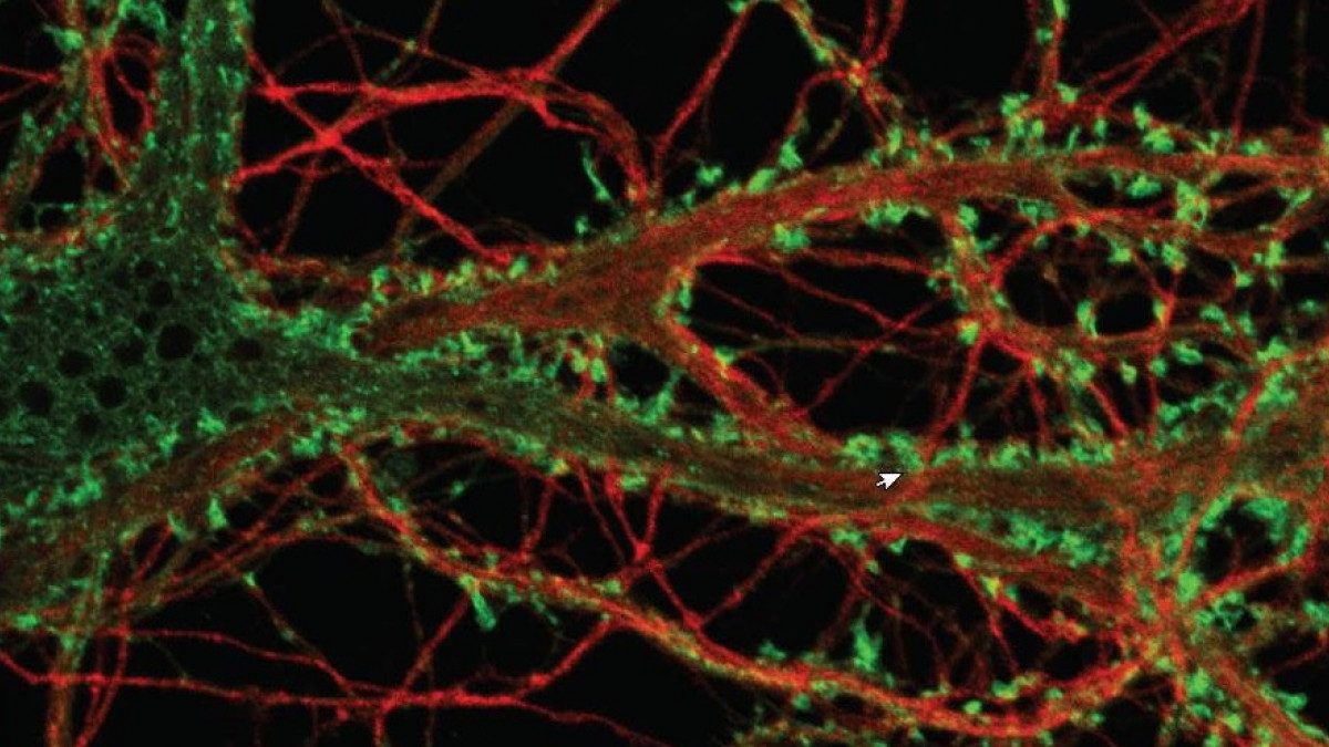 Neuronas dopaminérgicas: características y funciones