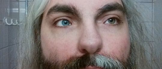 Síndrome de Waardenburg