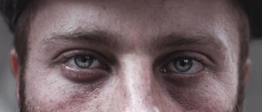 Trastorno de despersonalización