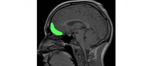 Corteza orbitofrontal