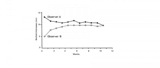 Investigación longitudinal