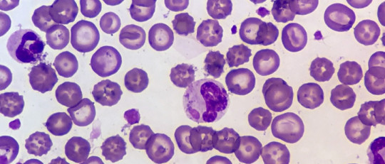 Eritrocitos (glóbulos rojos): características funcionamiento