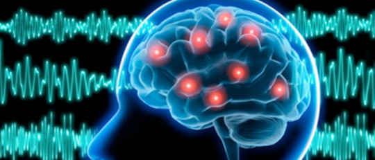 Epilepsia: definición, causas, diagnóstico y tratamiento