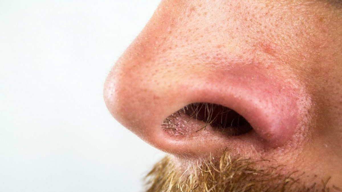 Cómo quitar los puntos negros de la nariz: 7 trucos y remedios
