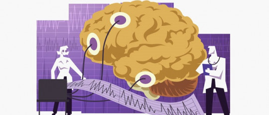 Las 5 principales tecnologías para el estudio del cerebro